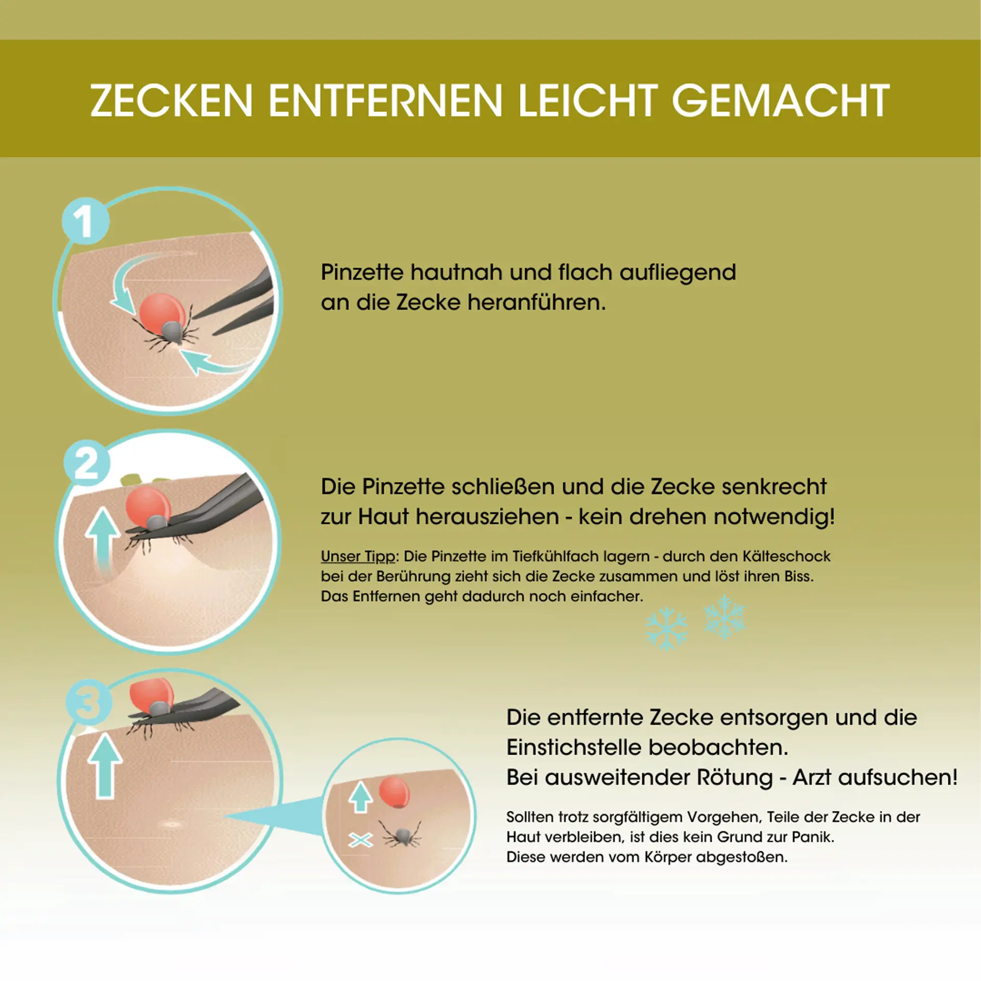 CANAL® ZECKENPINZETTE FÜR MENSCHEN ROSTFREI 2144-02